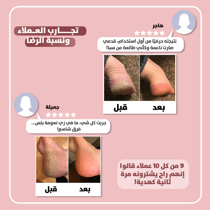آلة تنعيم القدم الإلكترونية - نعومة بلس